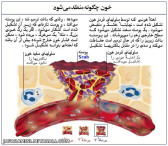 چگونه خون منعقد میشود