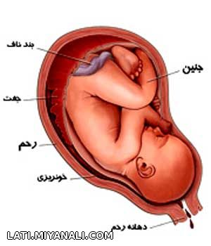 14 علت لکهبینی در بارداری