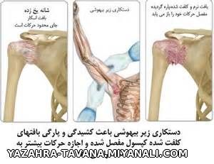 فیزیوتراپی ولیزردرمانی توانا