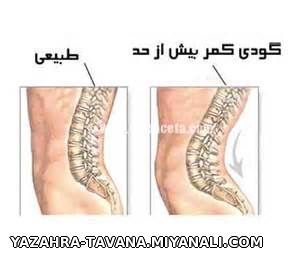 فیزیوتراپی ولیزردرمانی توانا